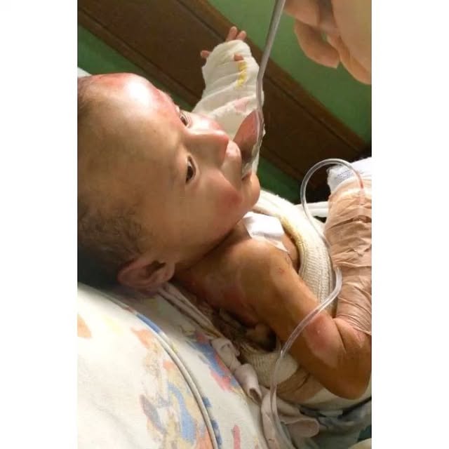 My beloved Abby!! One of our #Throwback #charity angels whom we paid for her Hospital for over 8 months and this li